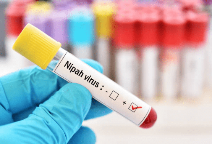 nipah virus Nipah virus testing